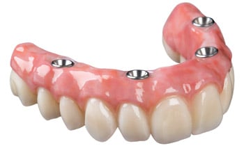 Zubne Proteze Kragujevac